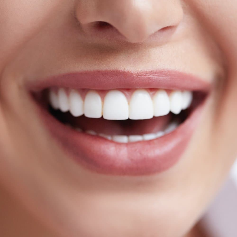 Close-up of a smile showing straight, even white teeth