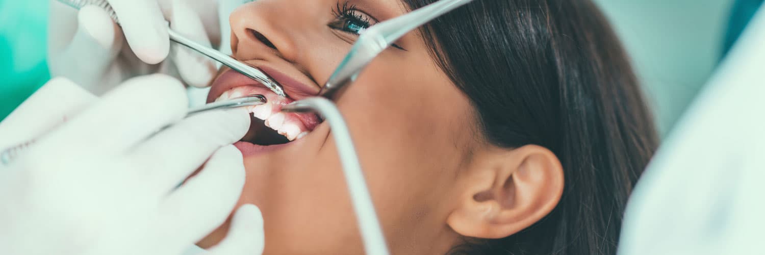 Achieve a Natural Smile with Composite Bonding at Levitas Dental Clinic London