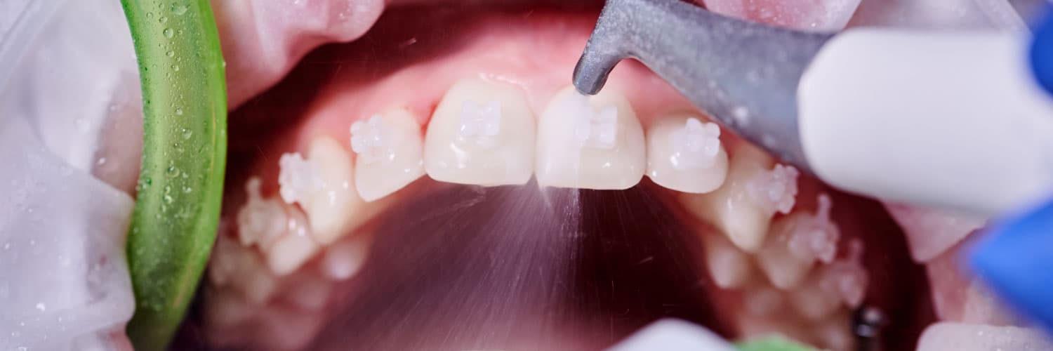 How Mouth Hygiene Treatments Enhance Cosmetic Dentistry Results