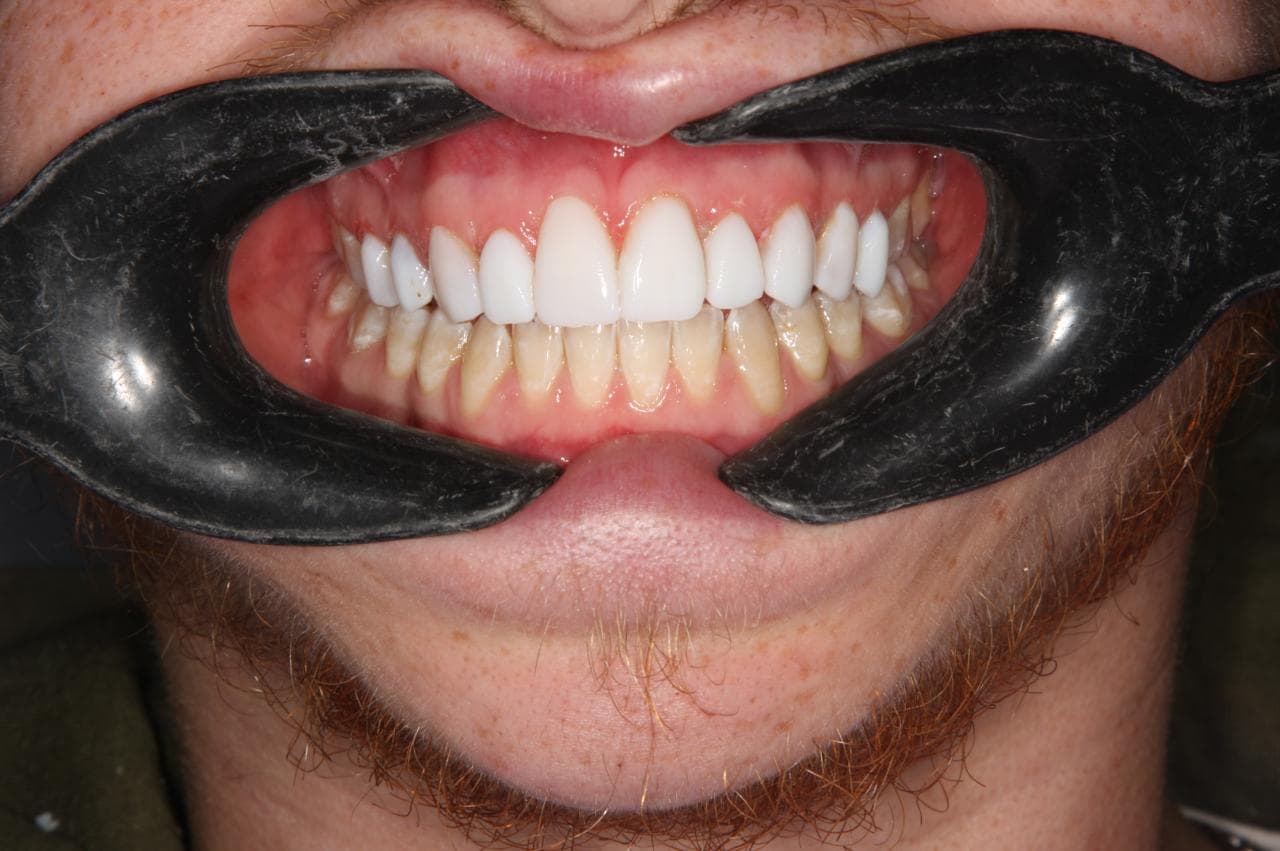 The Art of the Perfect Smile: Cosmetic Dentistry in Mayfair