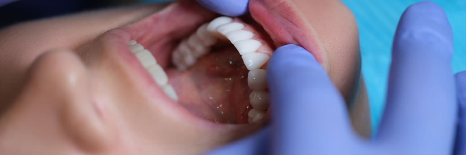 The Transformative Power of Regenerative Dentistry for Long-Term Oral Health