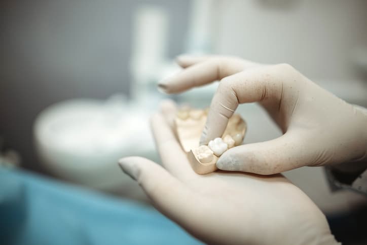 Dental Crowns in London and Surrey: Procedure, Benefits and Recovery Explained