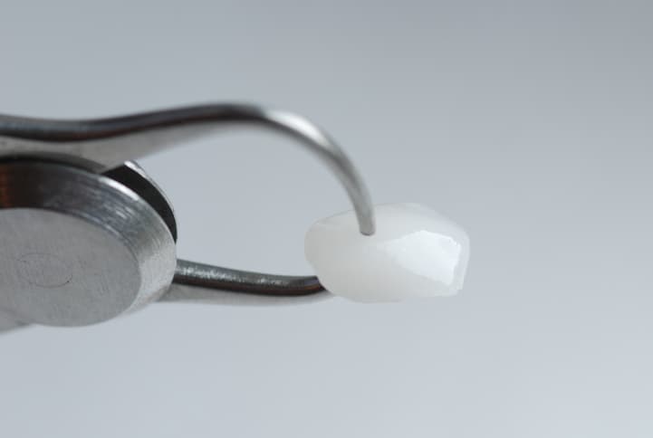 Porcelain Veneers in London & Surrey : A Complete Guide to Your Perfect Smile