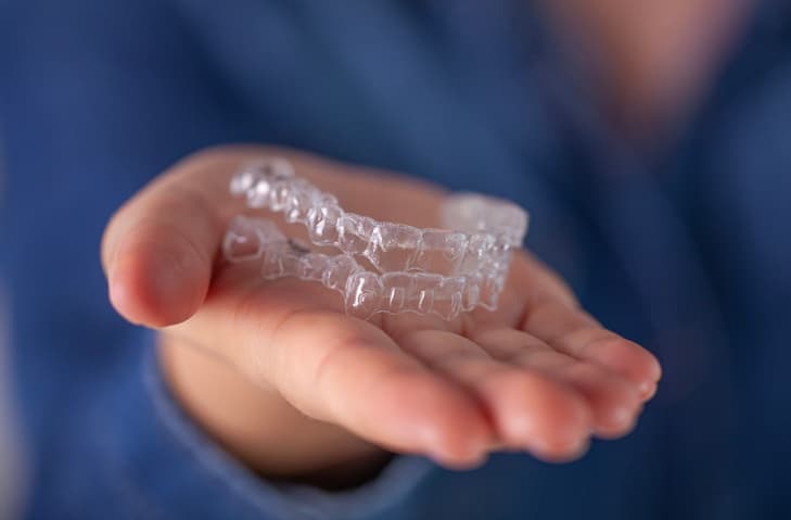 How Invisalign Works: The Science Behind Clear Aligners
