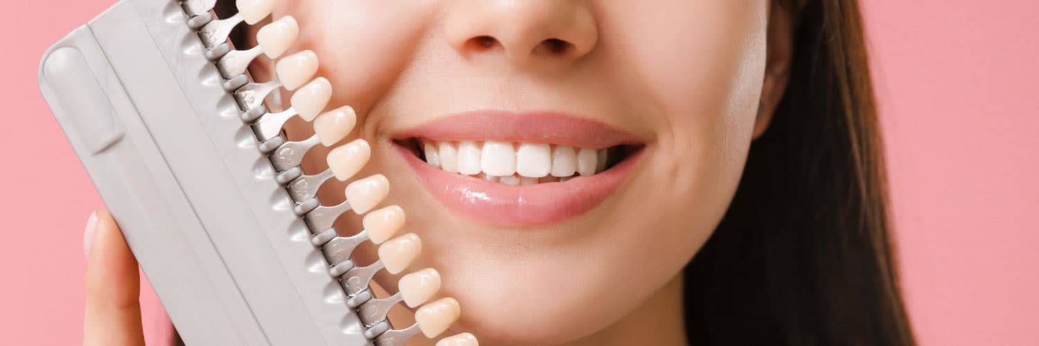 Veneers vs Composite Bonding: Which Cosmetic Option is Right for You?